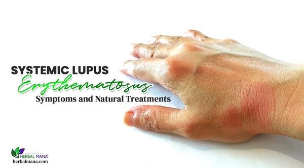 what is systemic lupus erythematosus symptoms of systemic lupus erythematosus and natural remedies man with lupus on hand setting hand on table white table background green and black text