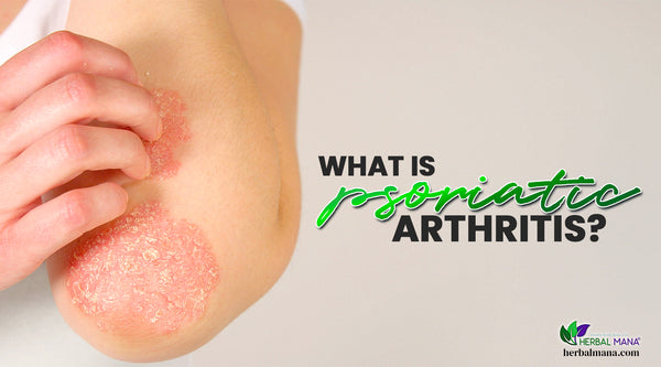 what is psoriatic arthritis causes symptoms of psoriatic arthritis and natural remedies for psoriatic arthritis woman scratching at psoriasis rash on elbow wearing white tank top with white background green and black text