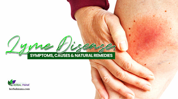 lyme disease symptoms causes natural remedies person with rash on leg close up