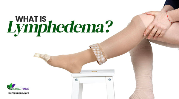 whats lymphedema causes symptoms natural remedies person with compression socks on resting their foot on a stool close up